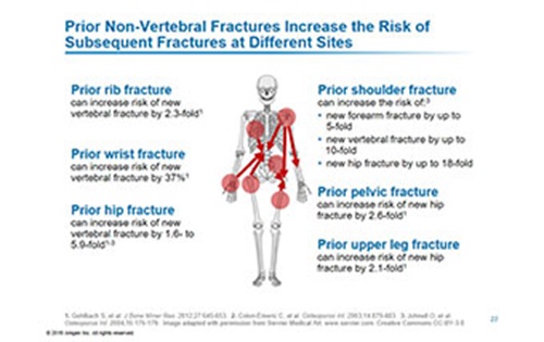 fragility-fractures