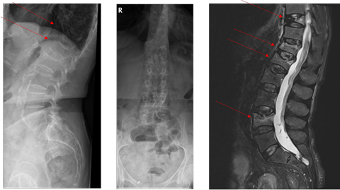 Bone images